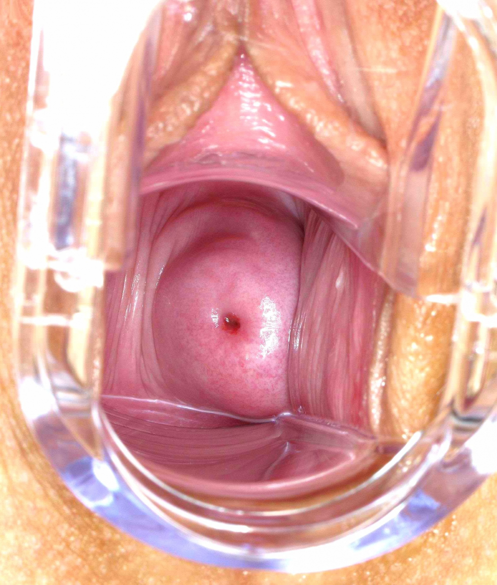 Dildo leaves gape showing cervix photo