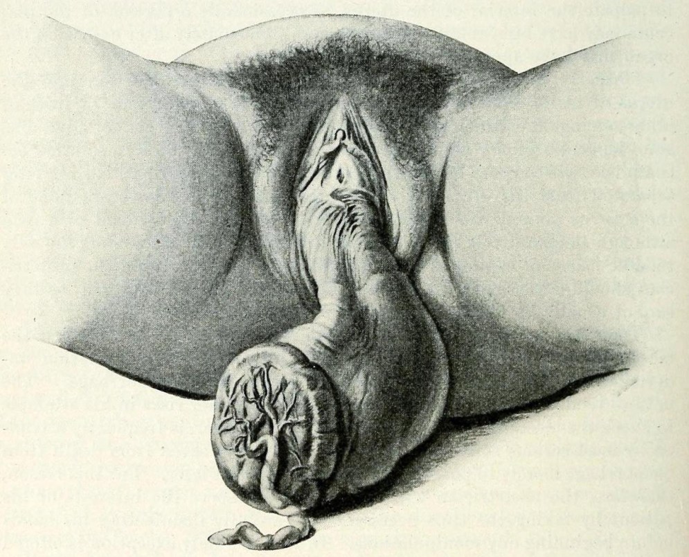 Naked old women drawn penis