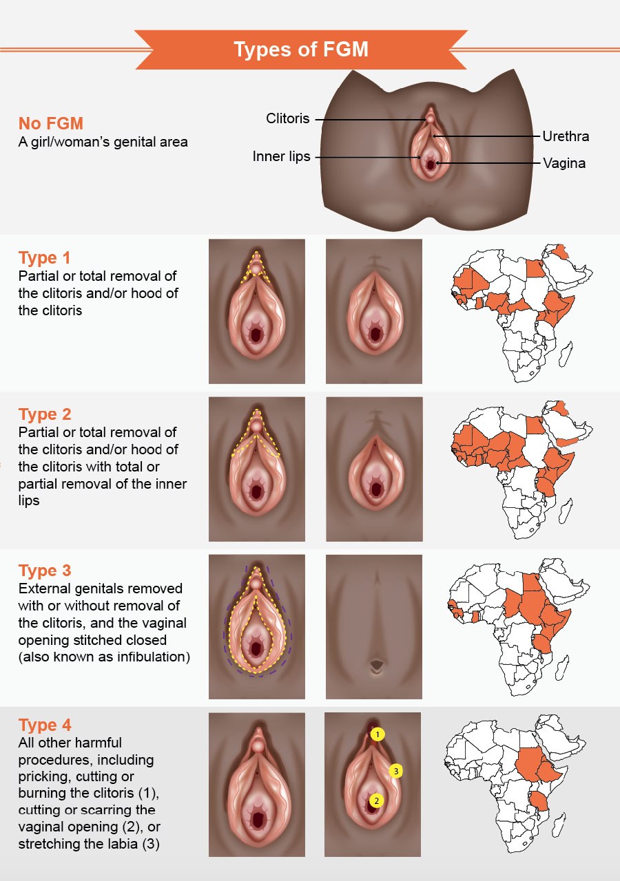 Sex with Circumcised Cuncs (71 photos)