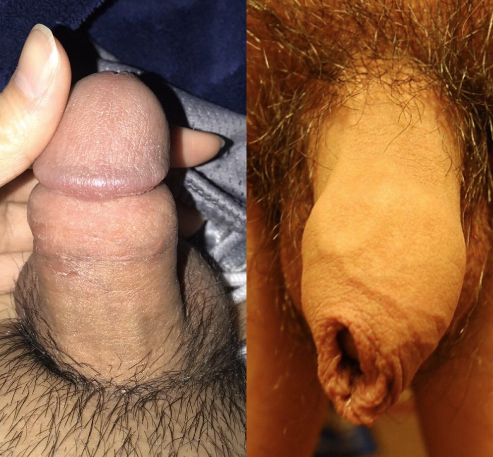 Amateur Mature Anus close -up